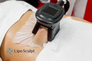 Are The Results From Aqualyx Permanent? 4 Compare Aqualyx Diss to other fat reduction treatments.