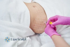 Are The Results From Aqualyx Permanent? 1 Do you want to know how long Aqualyx Diss results last?
