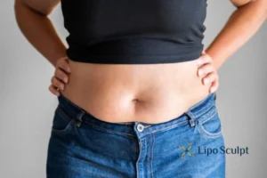 Bidding Farewell to Muffin Tops with Aqualyx Fat Injections 2 Do you wish you could reduce your muffin top Diss With Aqualy fat dissolving injections you can!